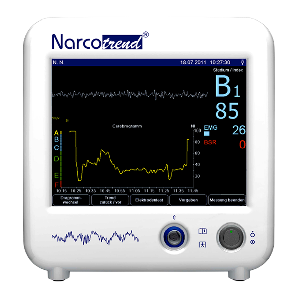 MONITOR DE ELECTROENCEFALOGRAMA (MONITOR DE PROFUNDIDAD ANESTÉSICA)